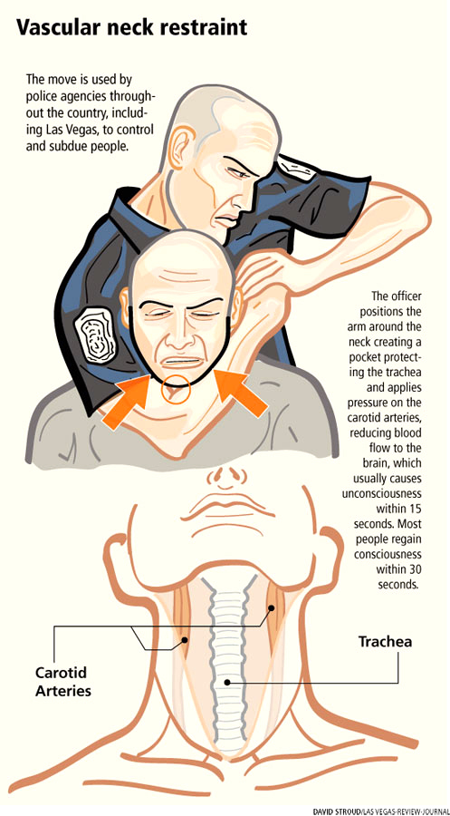 Physiology of Judo Choke Forensic Medicine Section